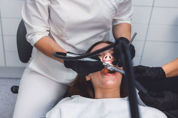 Best Emergency Tooth Extraction in Beach City, TX