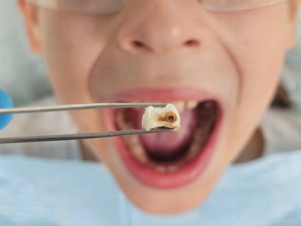 Best Cosmetic Emergency Dentistry in Beach City, TX