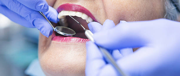 Best Emergency Treatment for Dental Infections or Abscesses in Beach City, TX